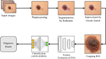 Automated Skin Cancer Diagnosis with DenseNet